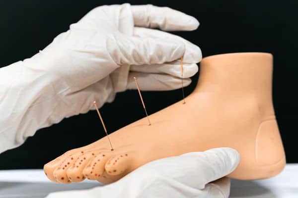 Sports Physiotherapy Treatment